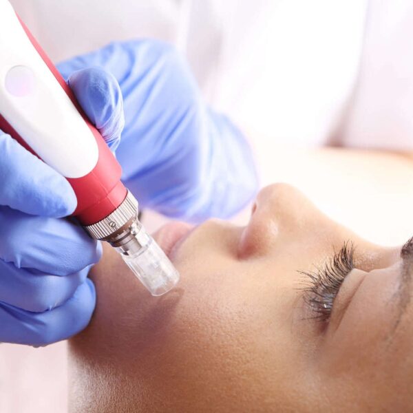 Dermapen N2 - Image 2